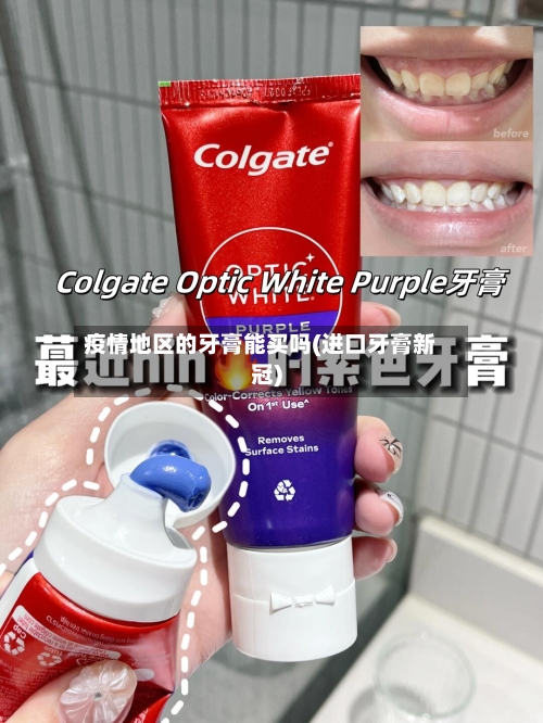 疫情地区的牙膏能买吗(进口牙膏新冠)-第2张图片